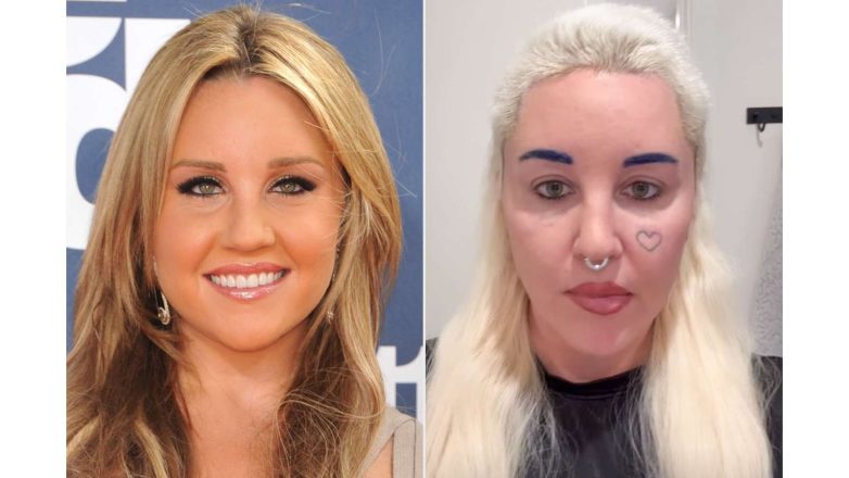 Amanda Bynes Plastic Surgery About Her Personal Life And Career