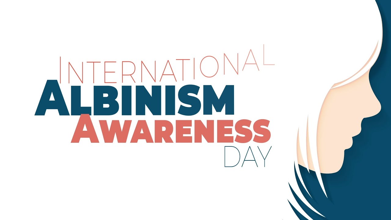 International Albinism Awareness Day 2022: Causes, Types and Treatment