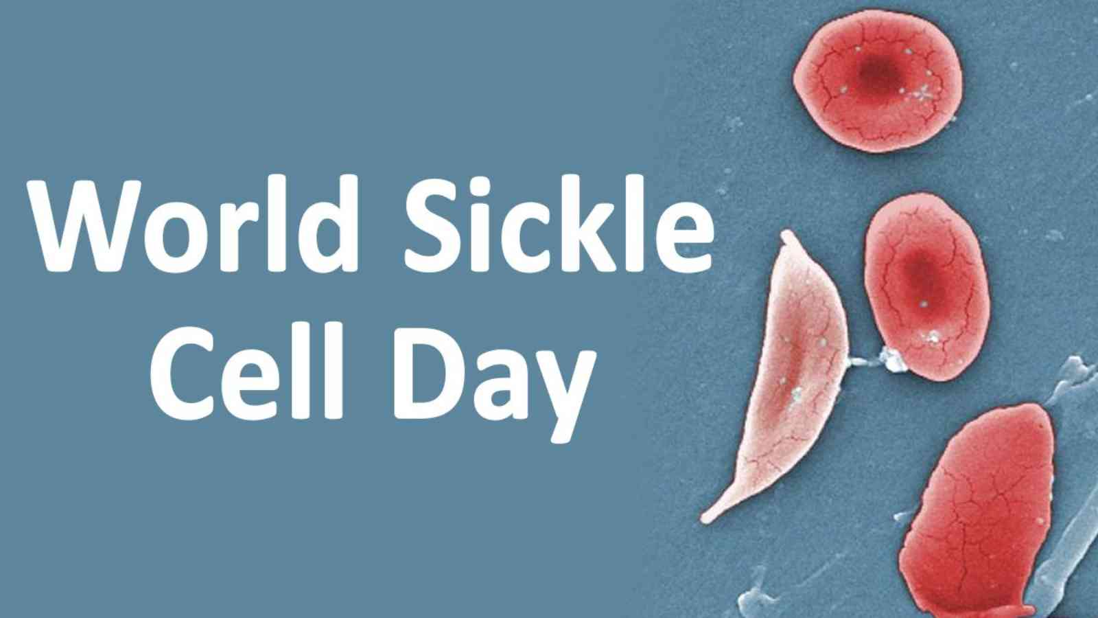 World Sickle Cell Day 2022: Date, Causes and Treatment
