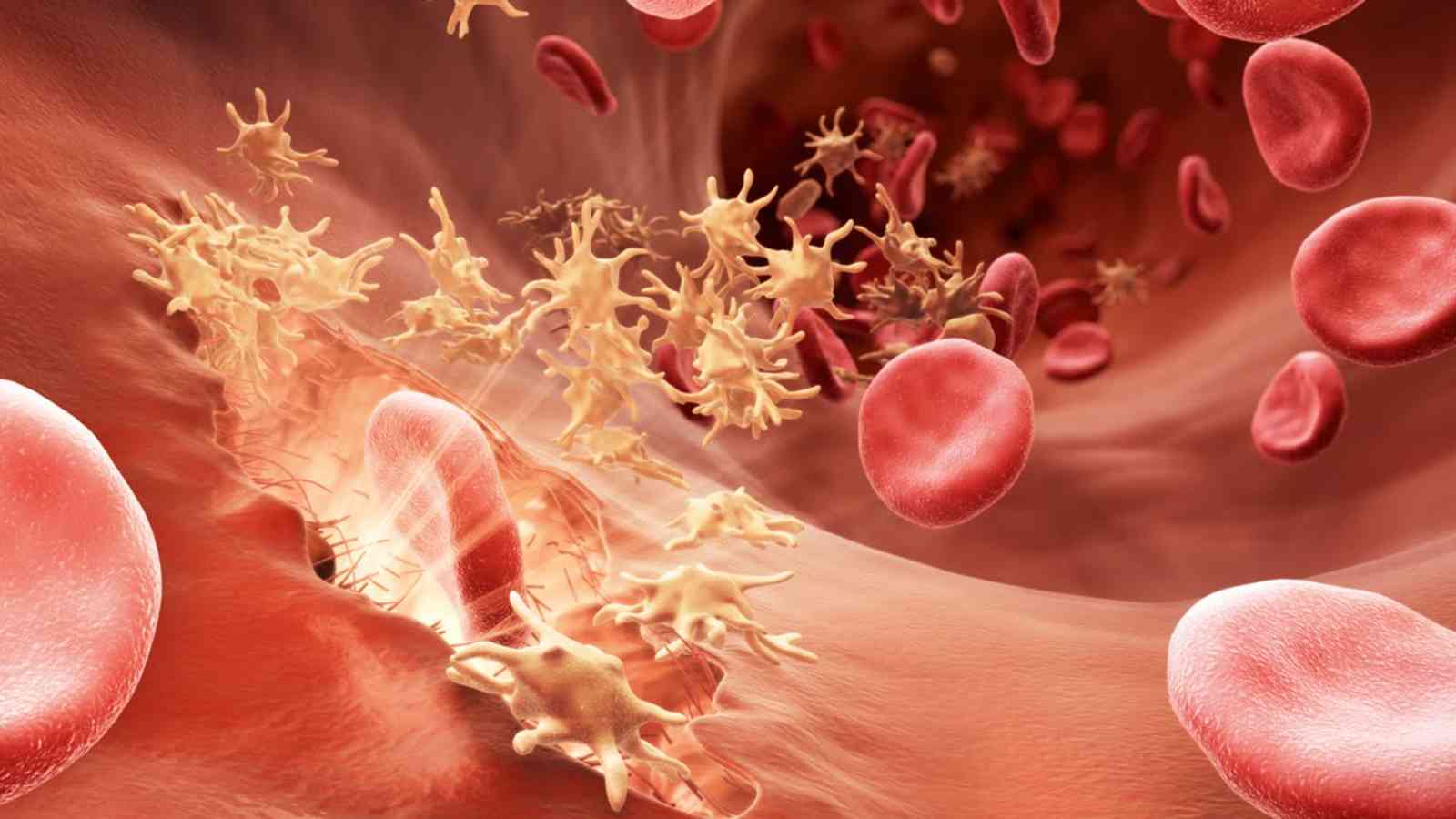 Understanding Hemophilia: Causes, risk and treatment