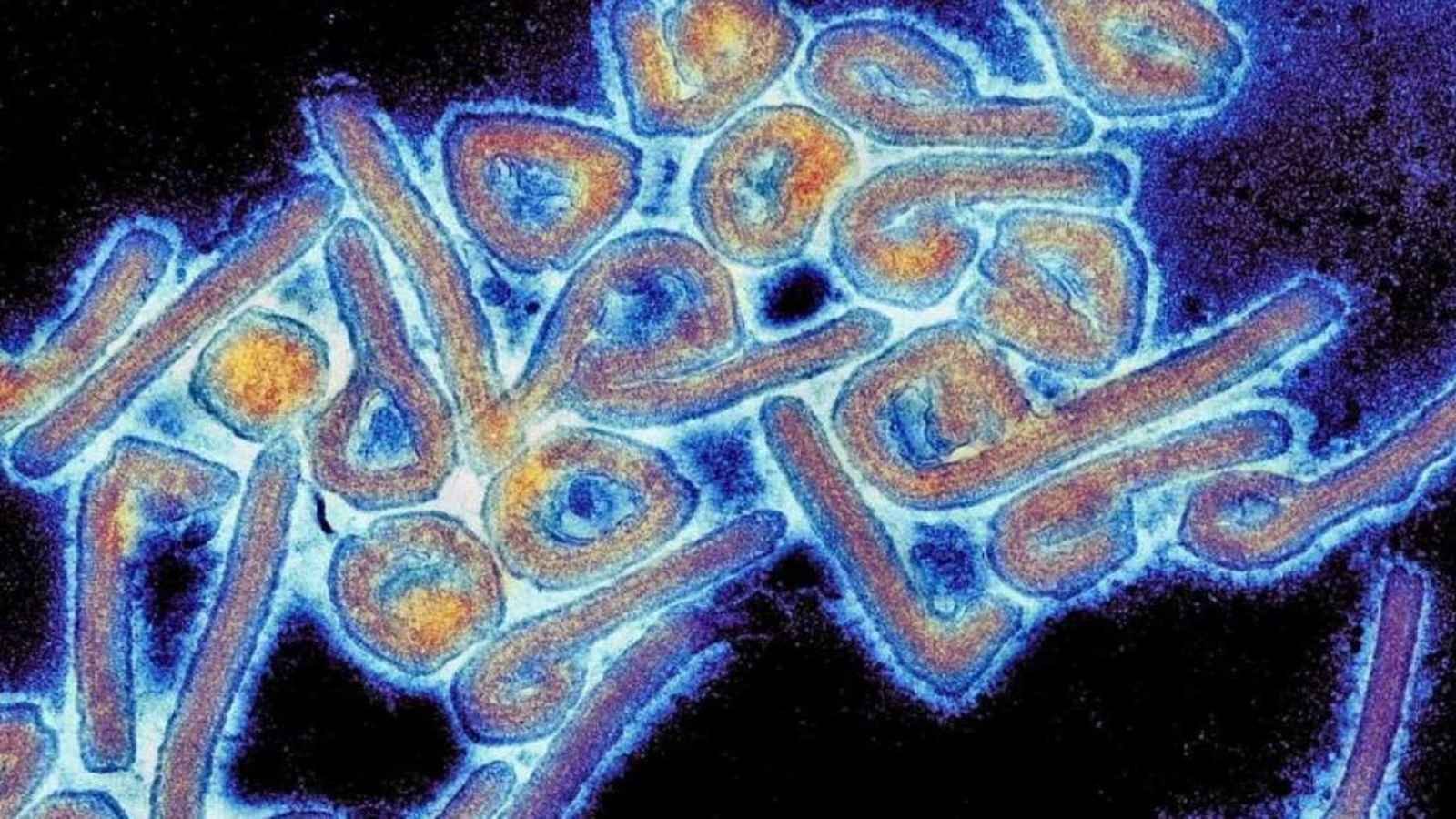 Marburg Virus (1) What Is Marburg Virus? Should We Be Worried?
