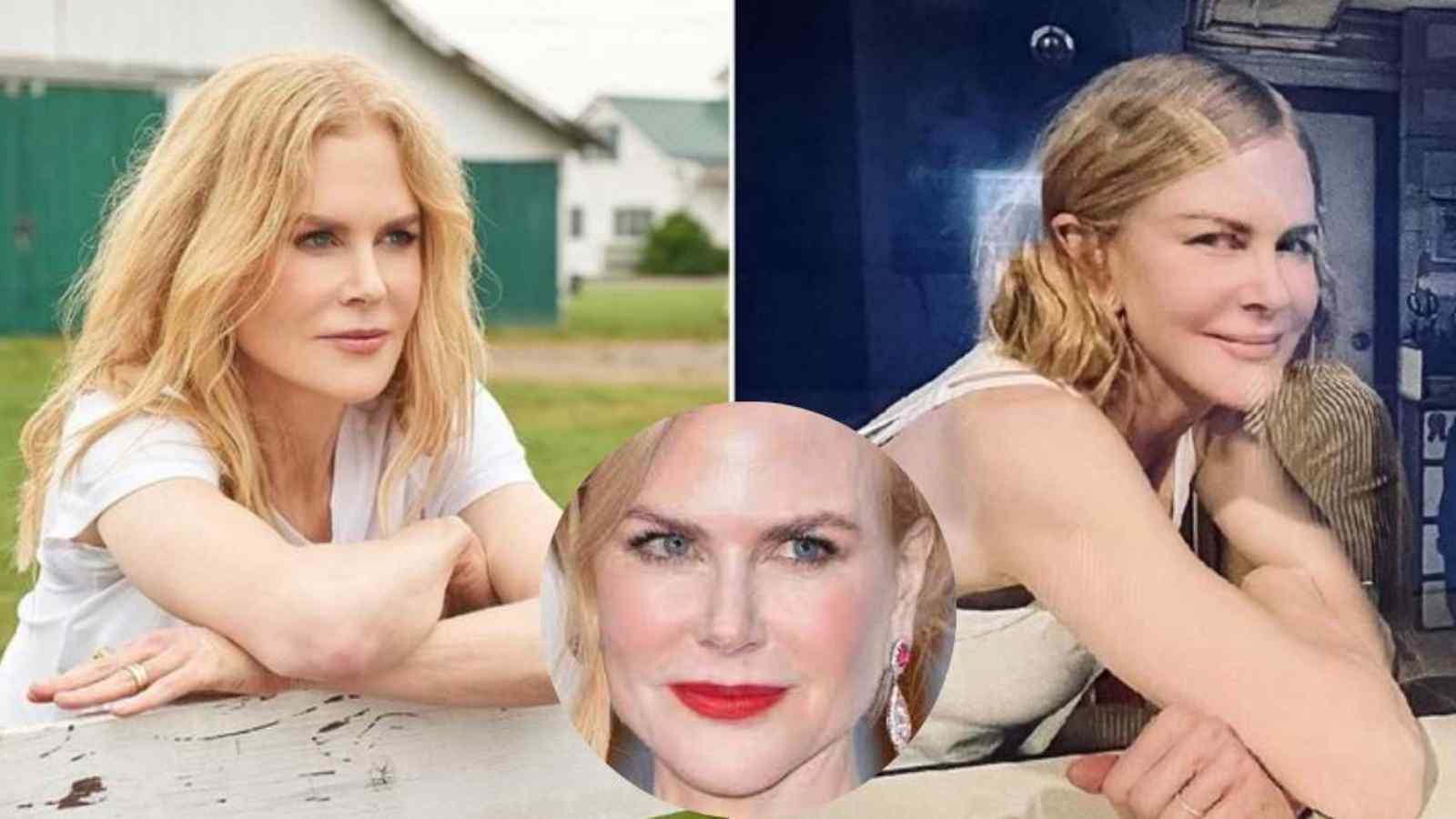 Nicole Kidman Plastic Surgery: Nose Job, Filler, Chin Implant