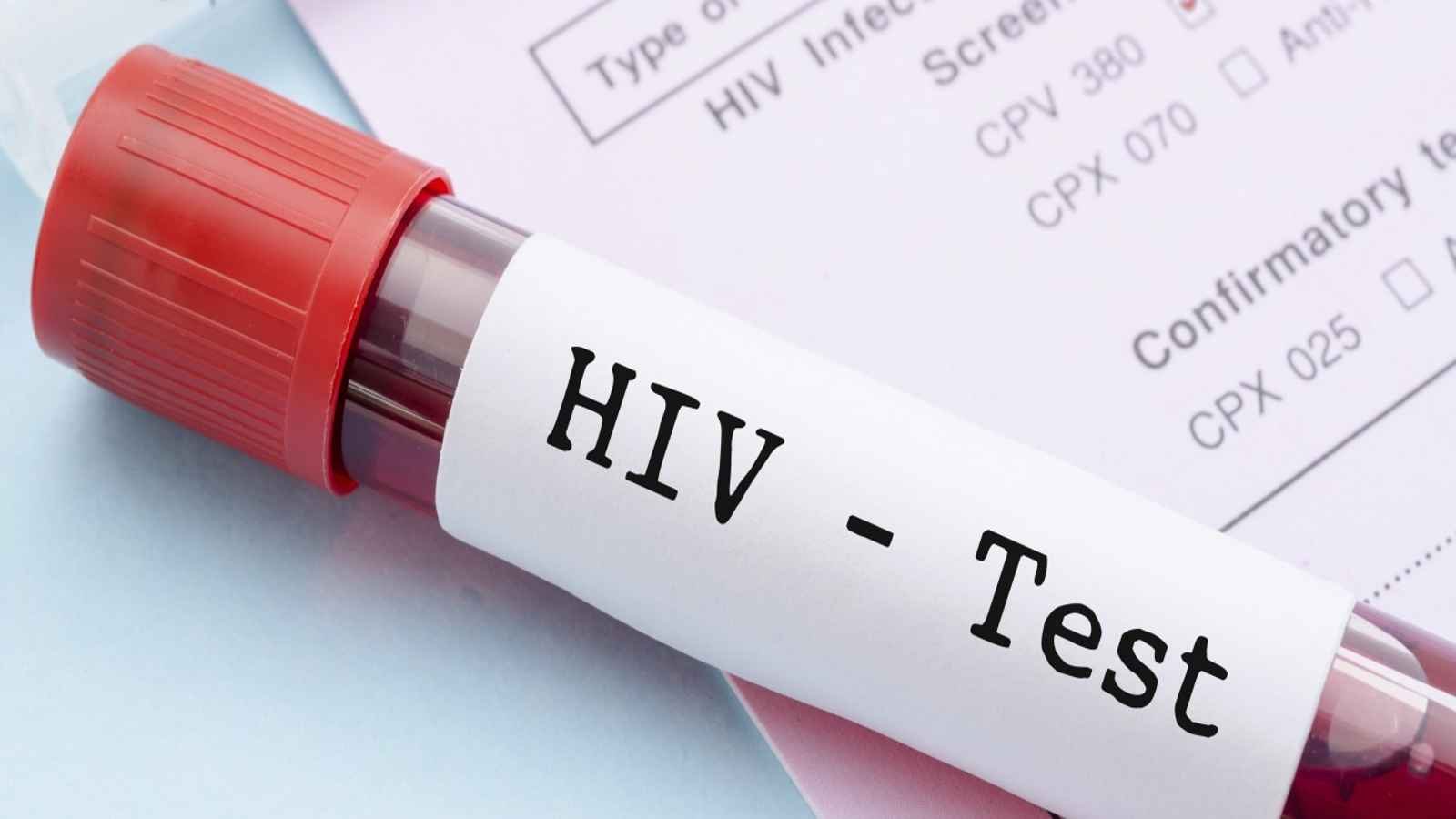 National HIV Testing Day National HIV Testing Day 2023: Date, History, Facts about HIV