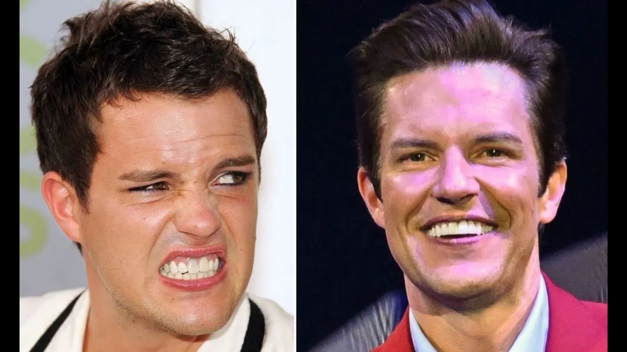 Brandon Flowers Plastic Surgery Before And After Transformation