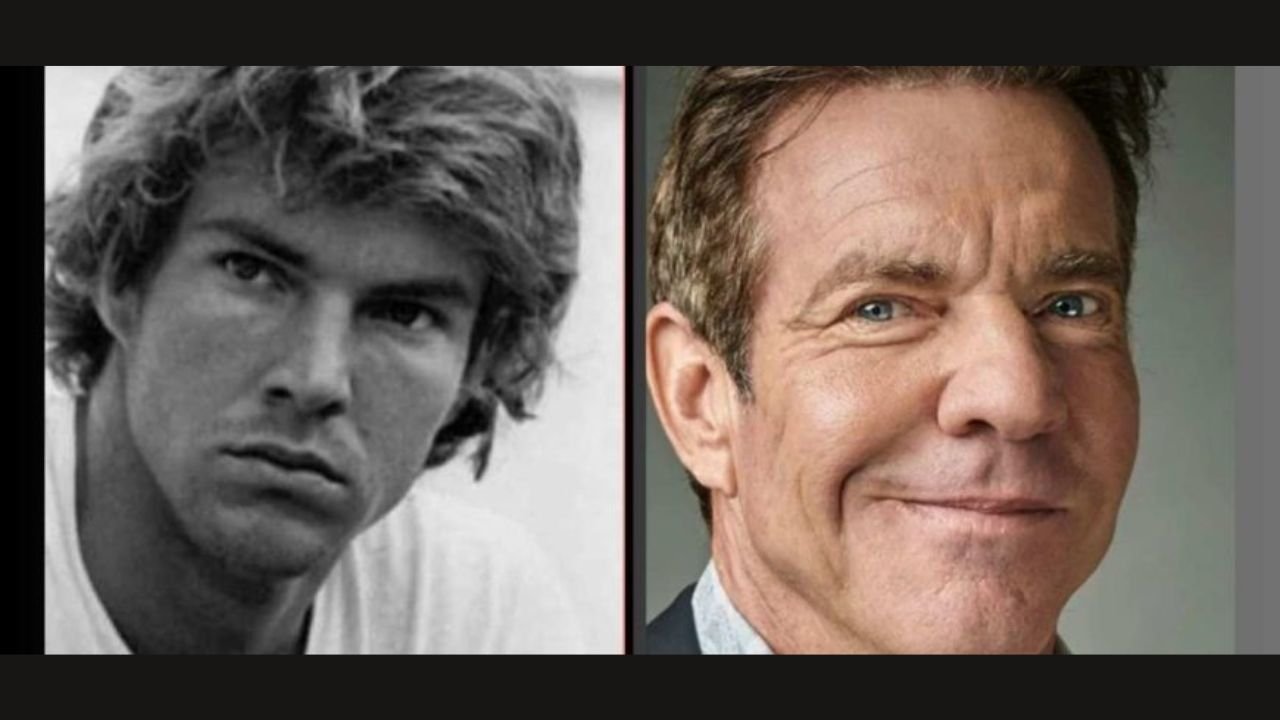 Dennis Quaid Plastic Surgery Dennis Quaid Plastic Surgery