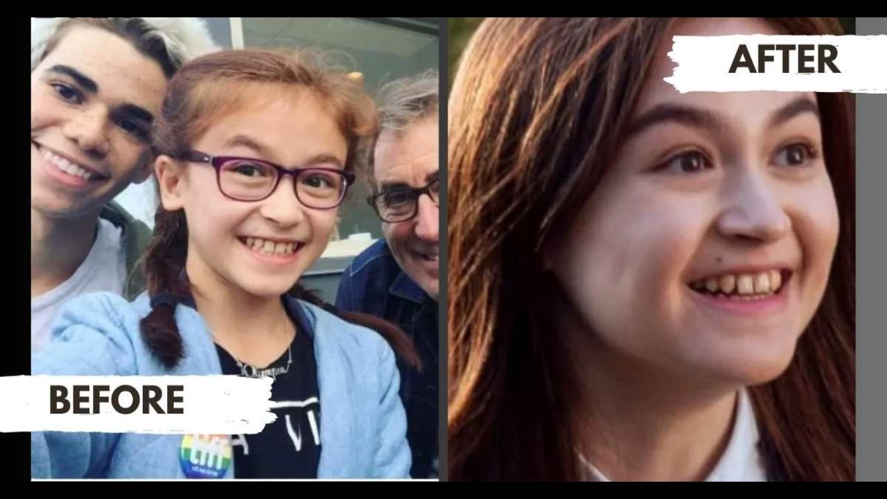 Why Anna Cathcart Teeth's Topic Is Trending On Social Media Why Anna Cathcart Teeth's Topic Is Trending On Social Media