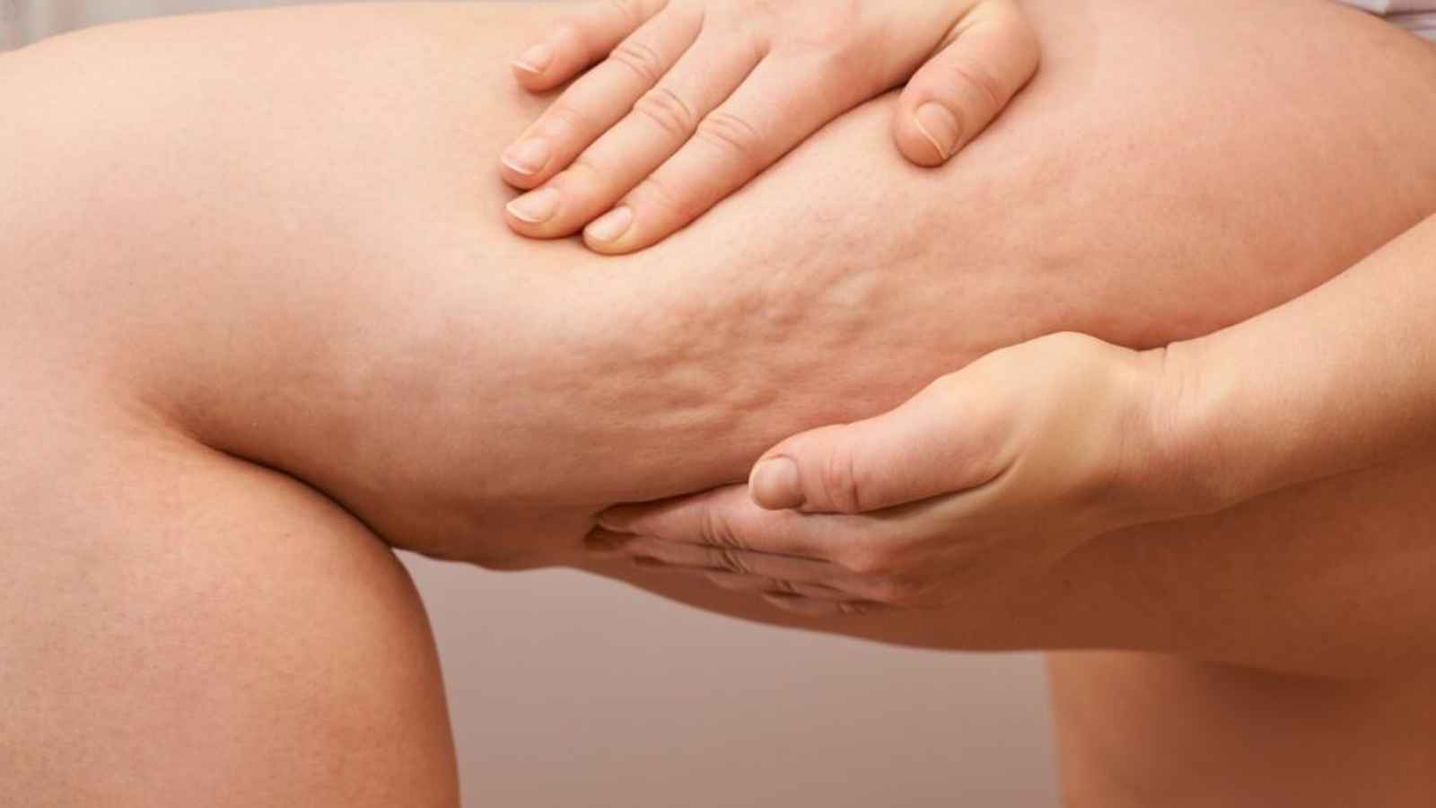 National Cellulite Day 2023: Date, History, Facts, Events