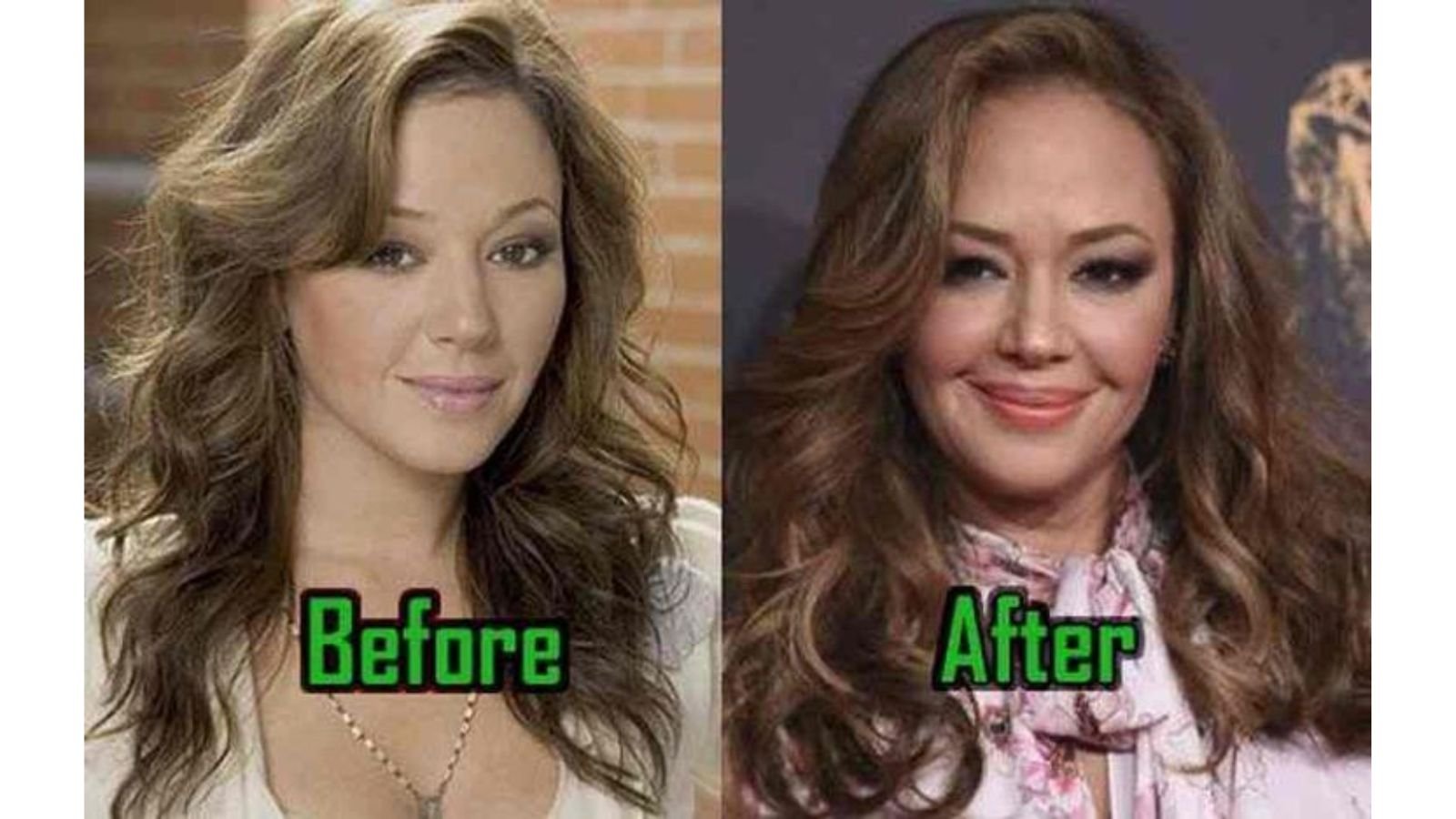 Leah Remini Plastic Surgery Leah Remini Plastic Surgery