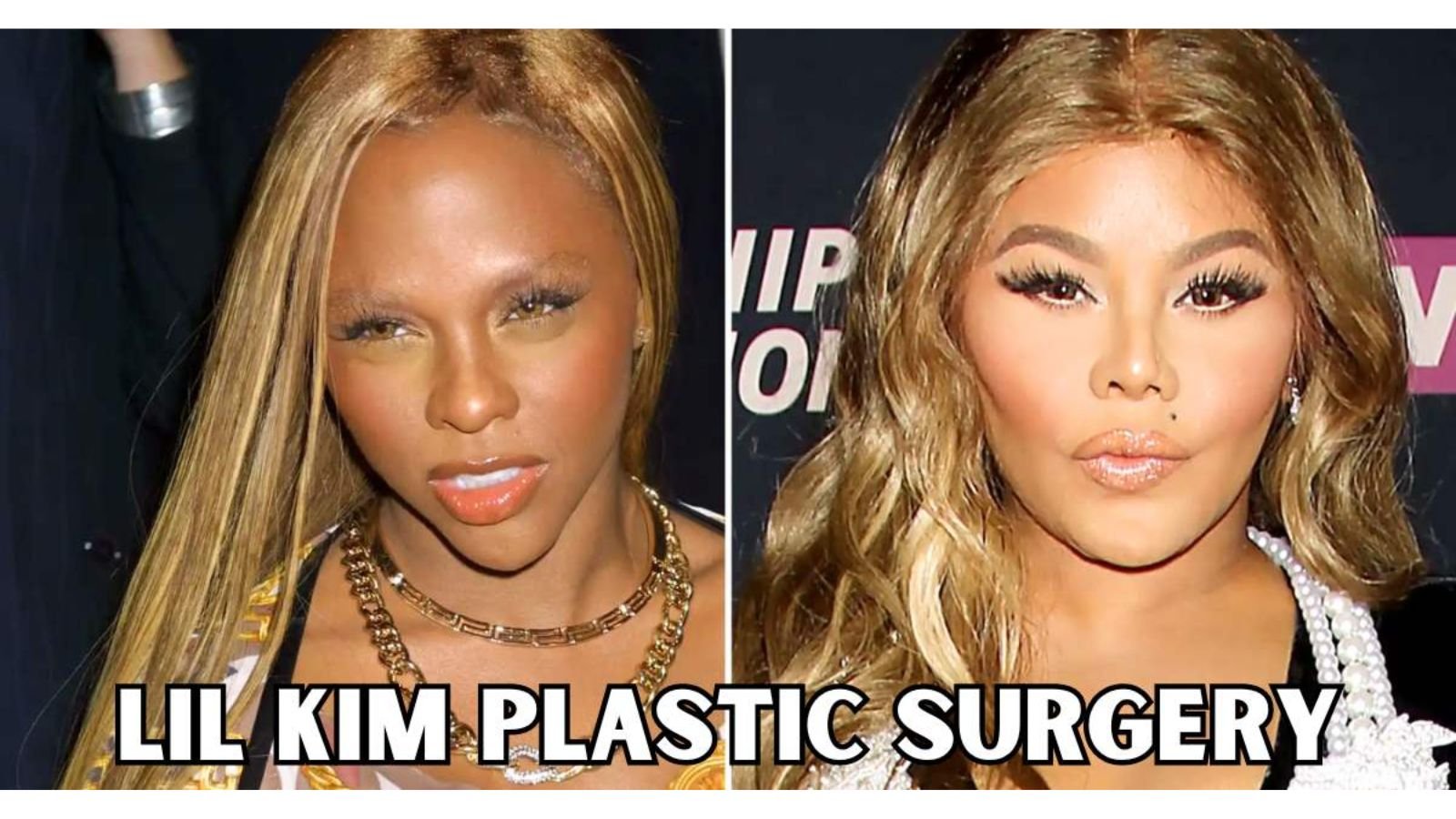 Lil Kim Plastic Surgery Lil Kim Plastic Surgery