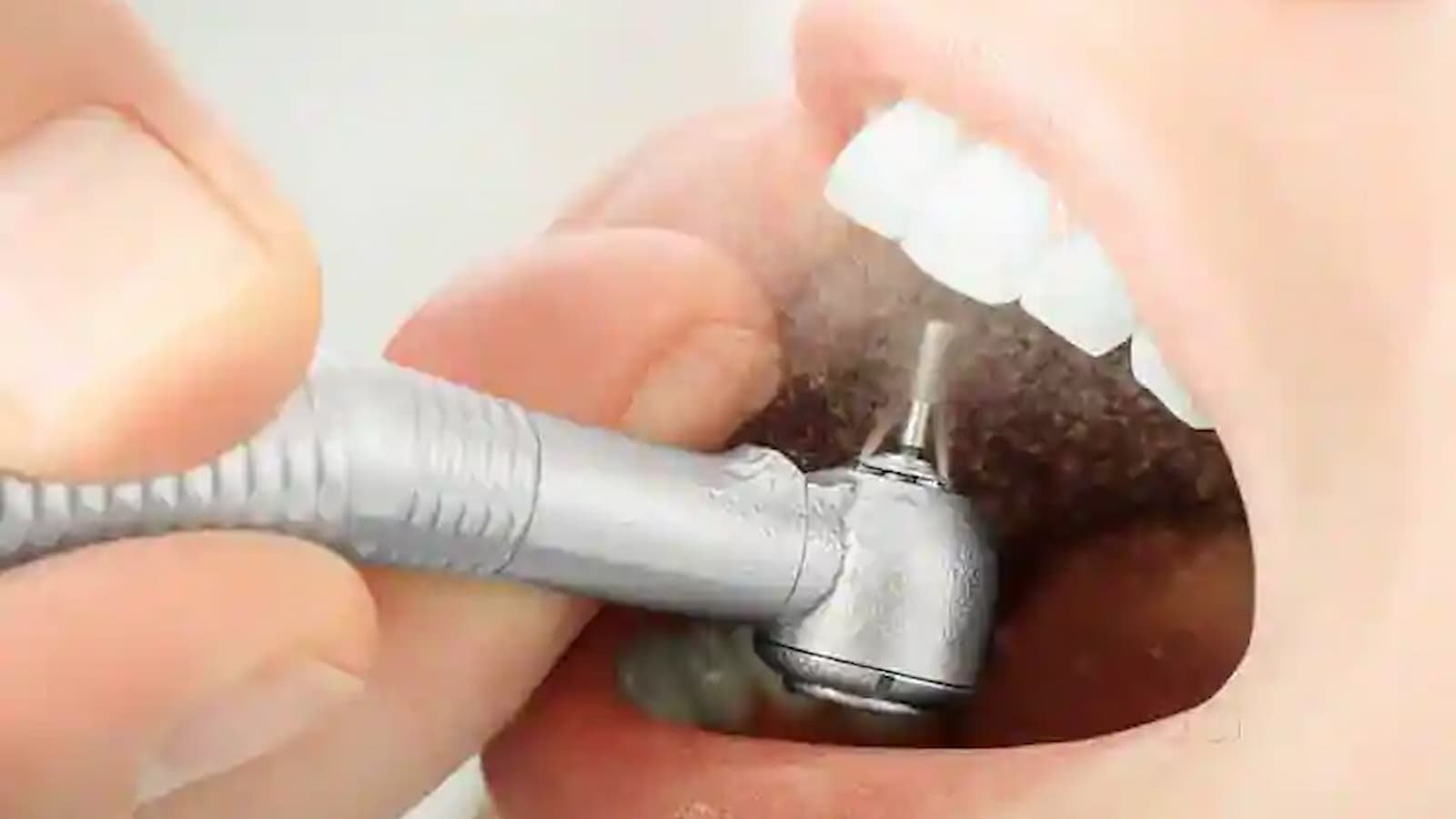 Dental Drill Appreciation Day Dental Drill Appreciation Day, Dental Drill Appreciation Day date, Dental Drill Appreciation Day 2024, Dental Appreciation Day, VA Dental Benefits