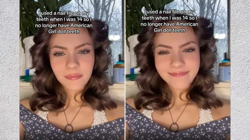 American Girl Doll Teeth How a Woman on TikTok Used a Nail File to Fix